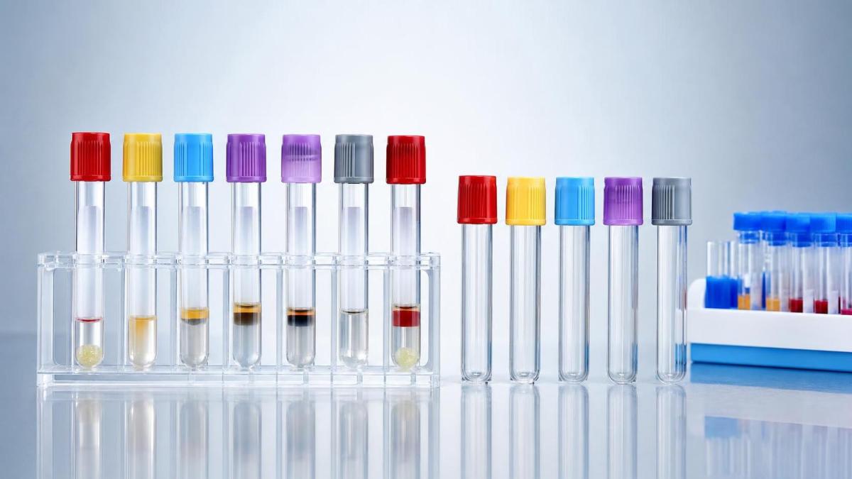 How to Compare Vacuum and Non Vacuum Blood Collection Tubes for Specific Tests How to Compare Vacuum and Non Vacuum Blood Collection Tubes for Specific Tests