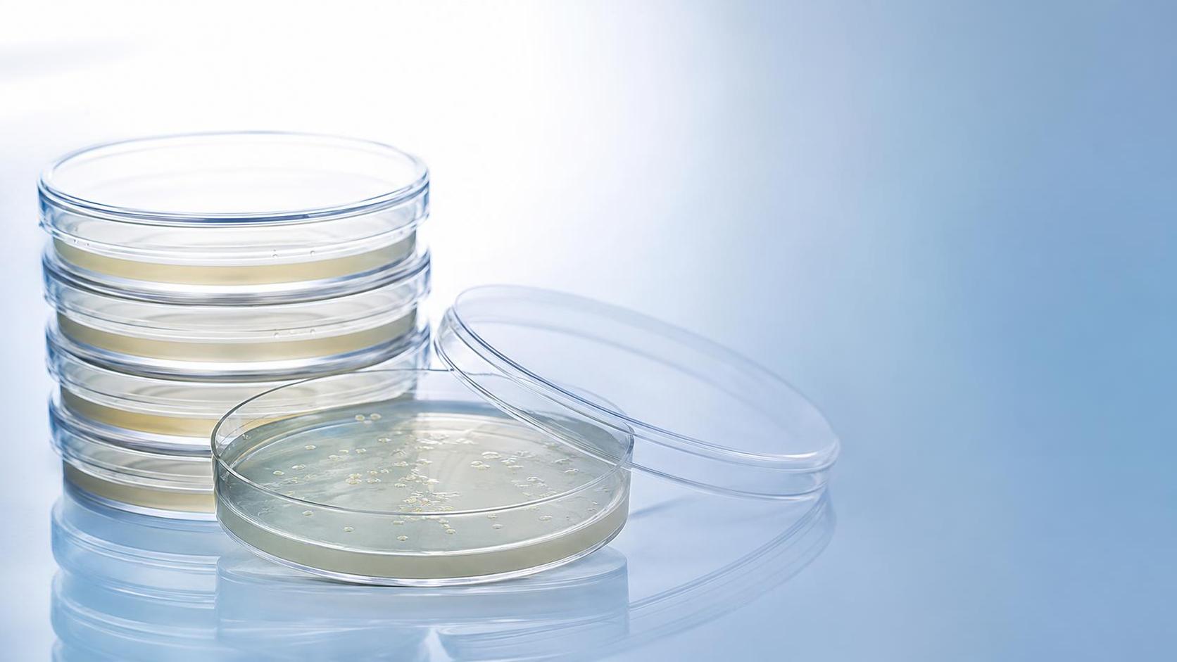 Petri Plates Explained: Materials, Sizes, and Best Uses in Microbiology Labs